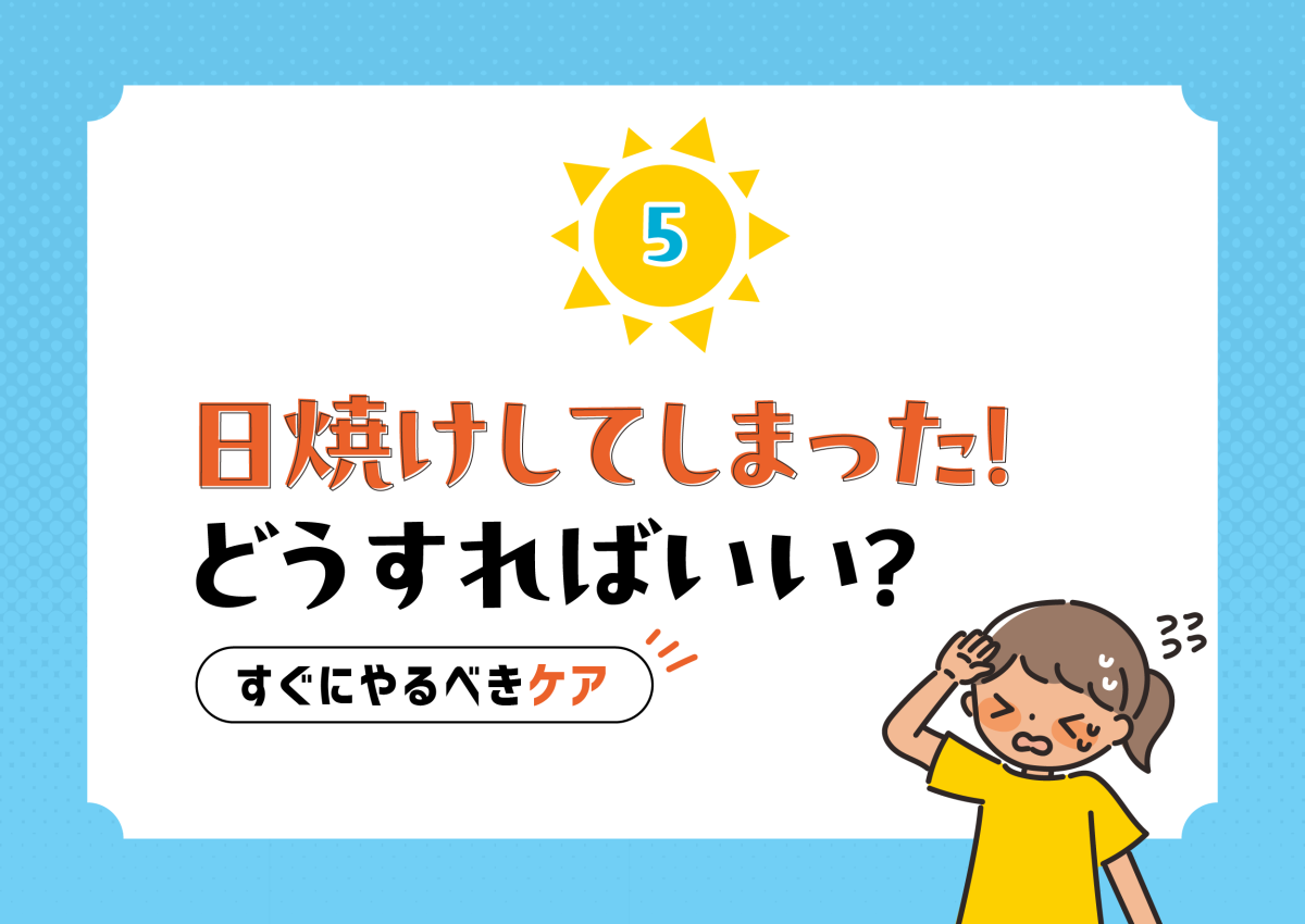 日焼けしてしまった！　どうすればいい？